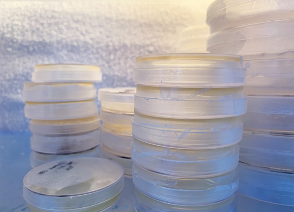 焦磷酸檢測(cè)